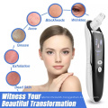 Electric Adjustable Suction Power Blackhead Remover Extractor Tool